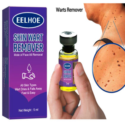 Aachil Remover